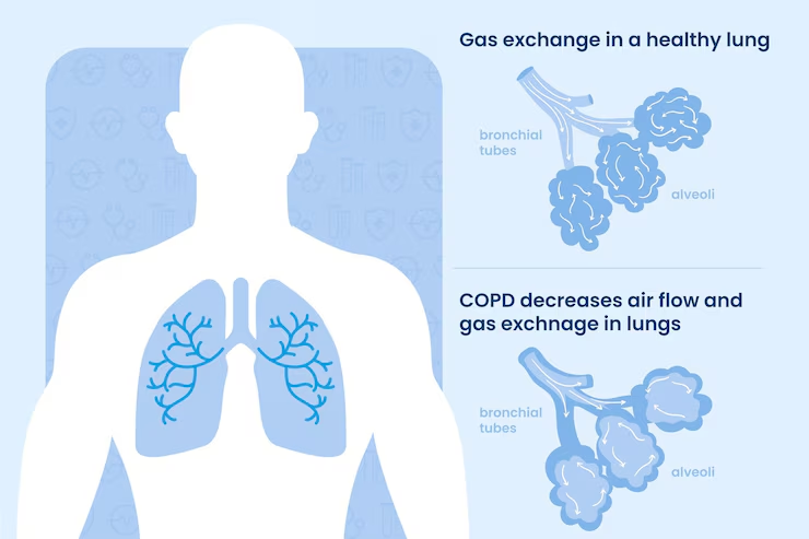 NEET Biology MCQs Breathing and Exchange Of Gases [Free PDF]